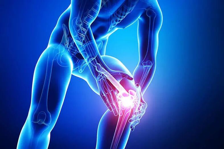 az arthrosis tünetei